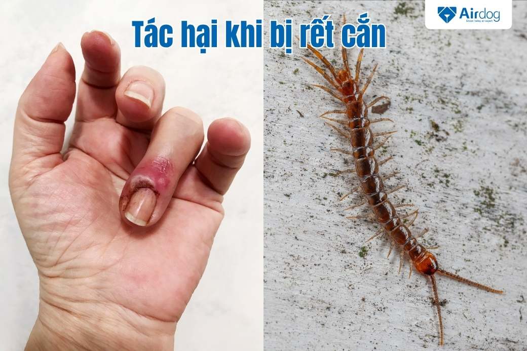 tác hại khi bị rết cắn